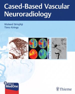 Imaging in Neurovascular Disease: A Case-Based Approach