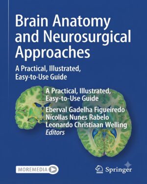 Brain Anatomy and Neurosurgical Approaches: A Practical, Illustrated, Easy-to-Use Guide