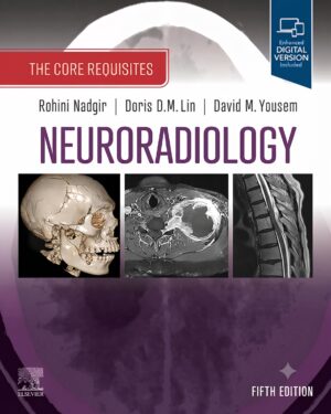 Neuroradiology: The Requisites E-Book: The Core Requisites