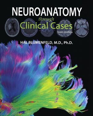 Neuroanatomy through Clinical Cases
