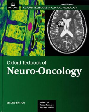 Oxford Textbook of Neuro-Oncology (Oxford Textbooks in Clinical Neurology)
