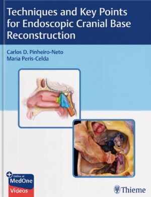Techniques and Key Points for Endoscopic Cranial Base Reconstruction With Videos