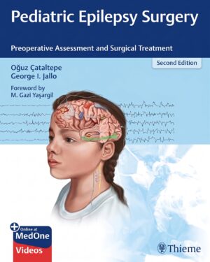 Pediatric Epilepsy Surgery: Preoperative Assessment and Surgical Treatment