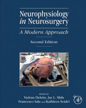 Neurophysiology in Neurosurgery: A Modern Approach
