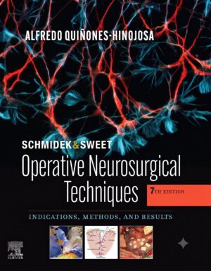 Schmidek and Sweet: Operative Neurosurgical Techniques: Indications, Methods and Results