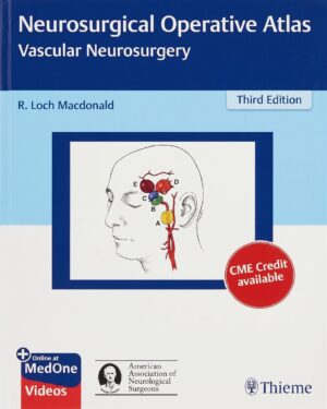 Neurosurgical Operative Atlas: Vascular Neurosurgery