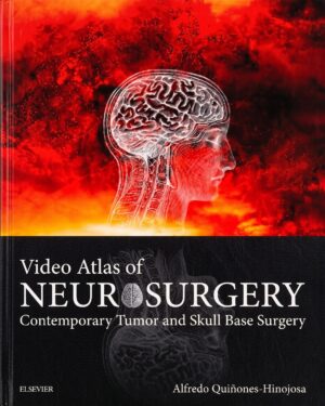 Atlas of Neurosurgery E-Book
