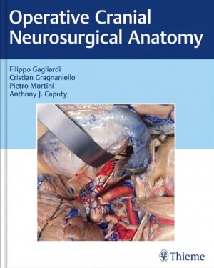 Neurosurgical Operative Atlas: Neuro-Oncology