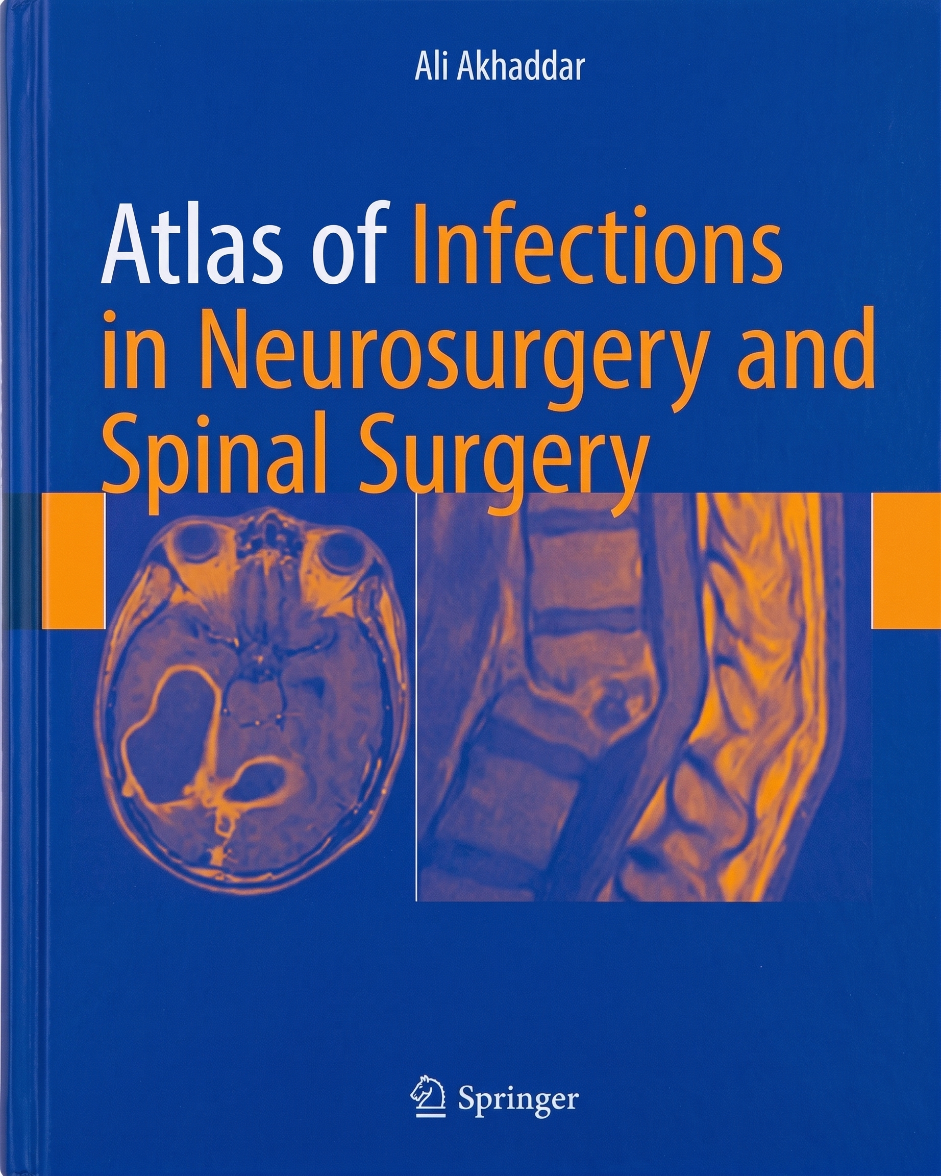 Atlas of Infections in Neurosurgery and Spinal Surgery