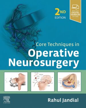 Core Techniques in Operative Neurosurgery: Expert Consult - Online and Print
