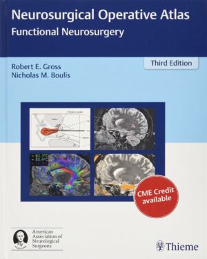 Neurosurgical Operative Atlas: Functional Neurosurgery